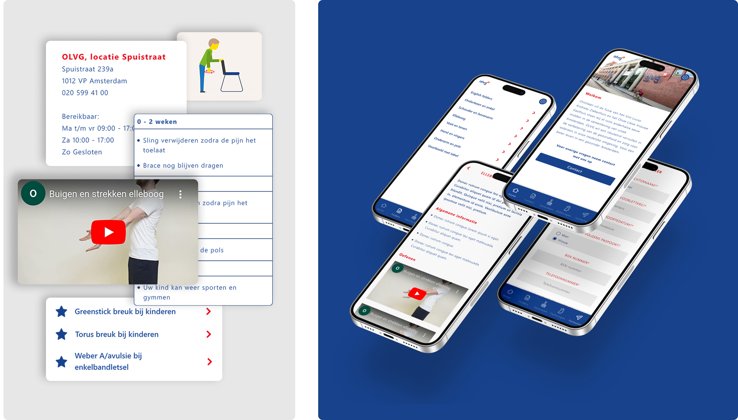 Mock-up Virtual Fracture Care